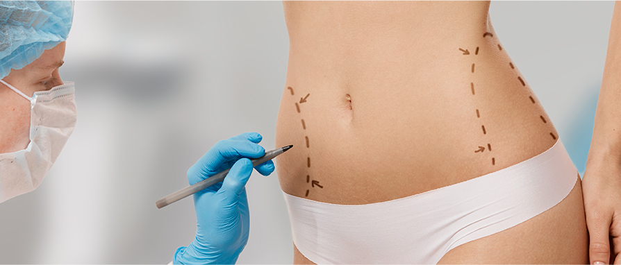 Rimodellamento del corpo: scolpire la figura perfetta